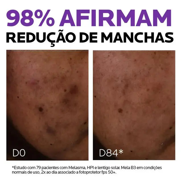 Sérum Antimanchas Facial La Roche-Posay Mela B3 Clareador Tratamento Antimanchas com Melasyl e Niacinamida B3 30ml