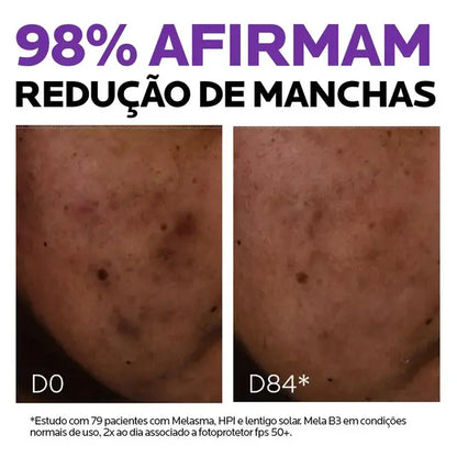 Sérum Antimanchas Facial La Roche-Posay Mela B3 Clareador Tratamento Antimanchas com Melasyl e Niacinamida B3 30ml