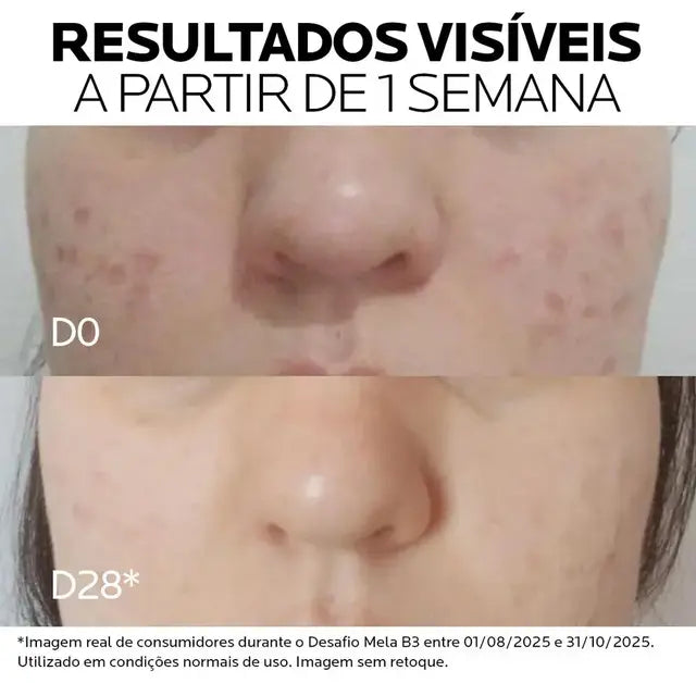 Sérum Antimanchas Facial La Roche-Posay Mela B3 Clareador Tratamento Antimanchas com Melasyl e Niacinamida B3 30ml